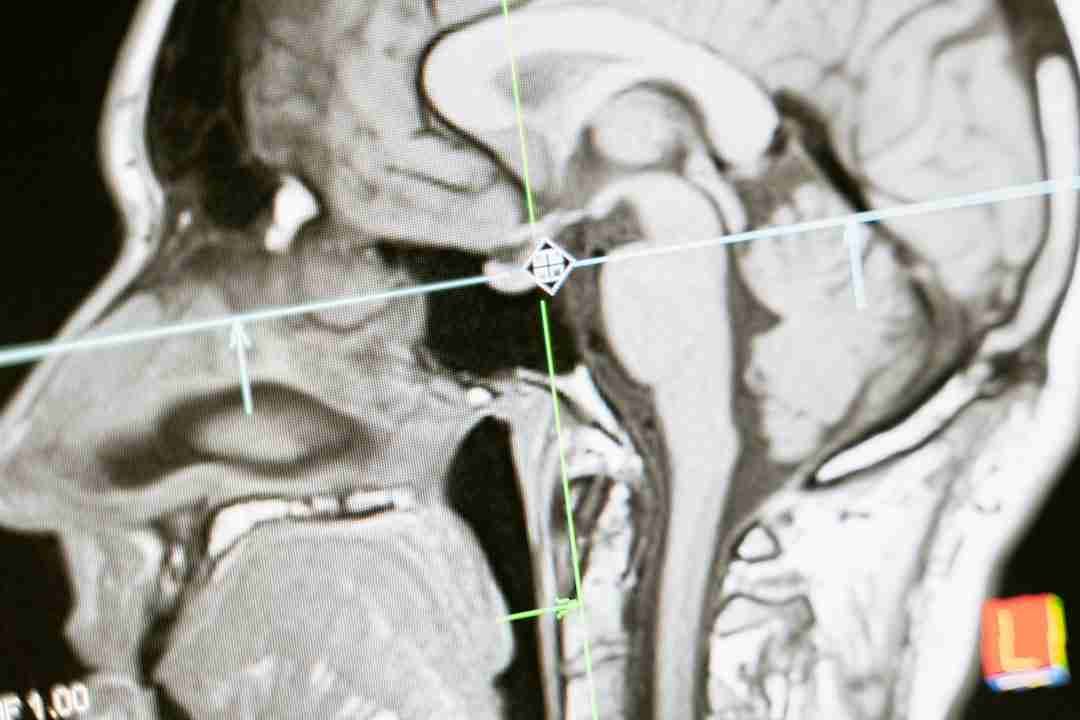 The Surprising Benefits of Sitting in Silence for Just 10 Minutes a Day