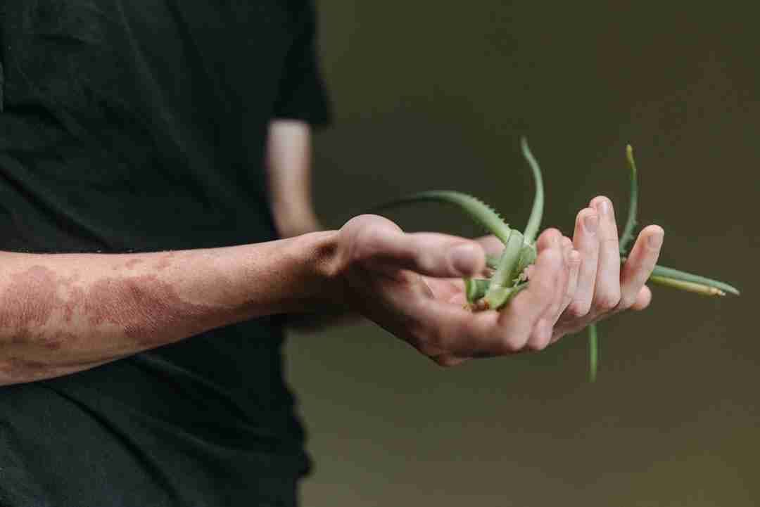 Aloe Vera for Sunburn Relief: Grandma's Go-To Remedy That Still Works